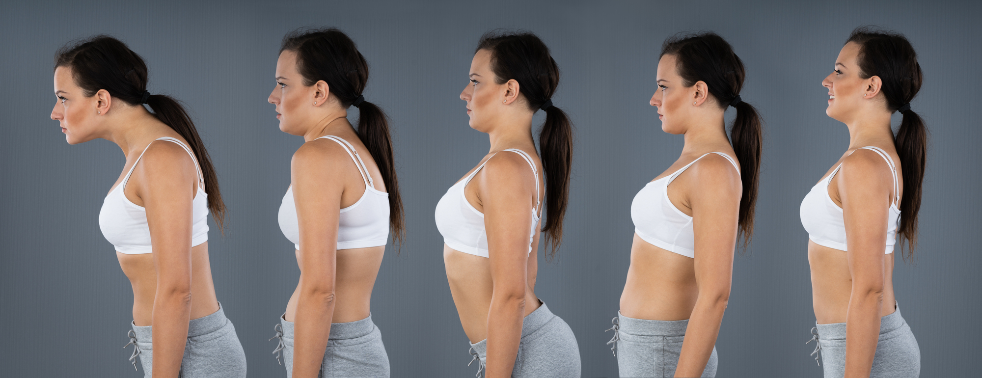 Correcting Forward Head Posture Through The Use Of Pilates